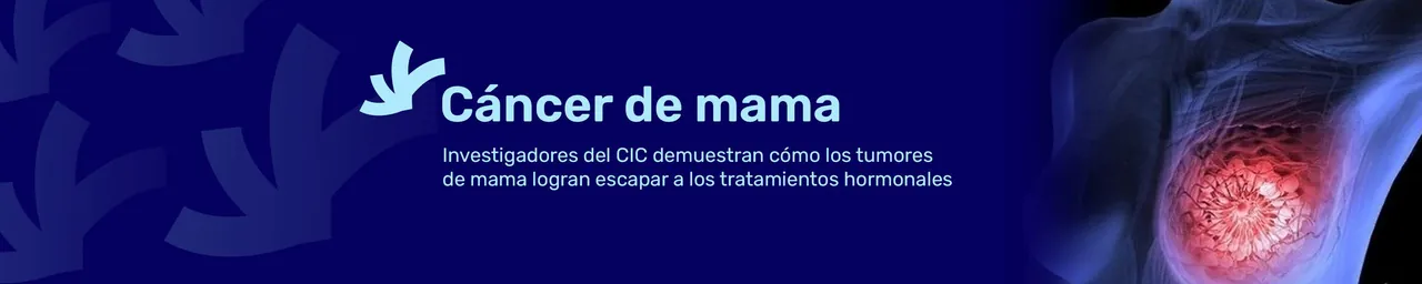 Banner web de una noticia sobre cáncer de mama